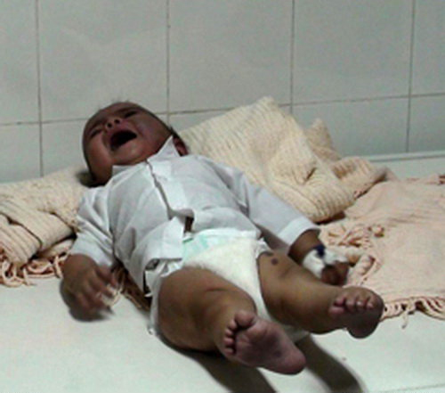شکنجه نوزاد توسط معتادان